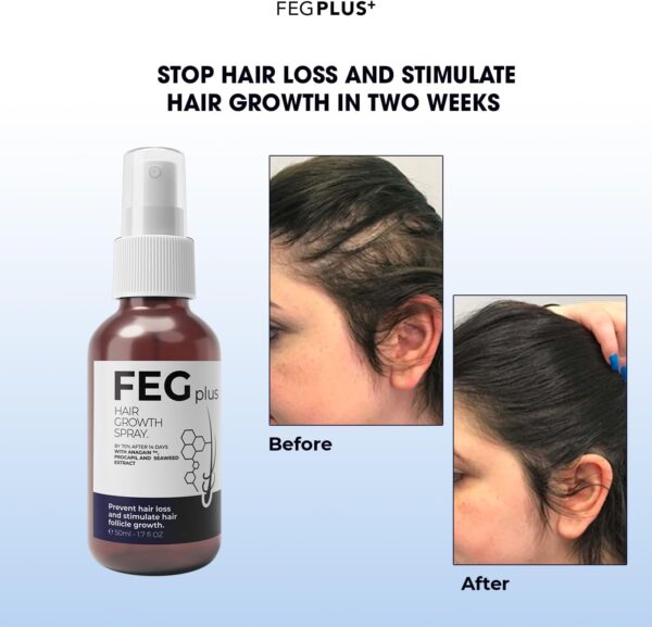 FEG hair removal growth - ghusoon mart - hair product - hair growth - غصون مارت